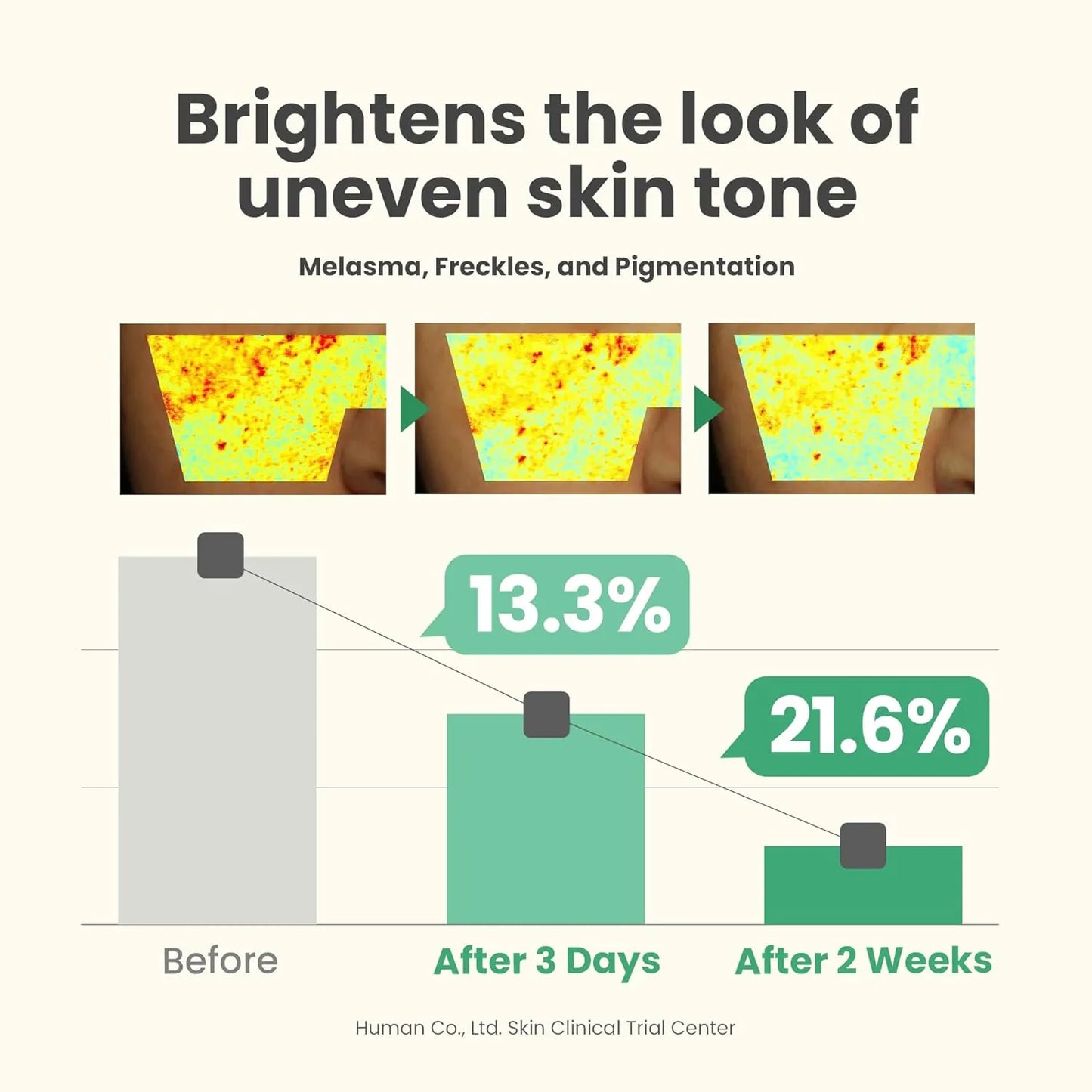 سيروم تصحيح البقع الداكنة  — سرّ توحيد البشرة وإشراقتها الطبيعيّة.